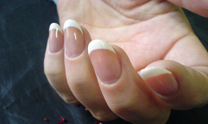 Псориаз ногтей: симптомы и лечение народными средствами в домашних условиях